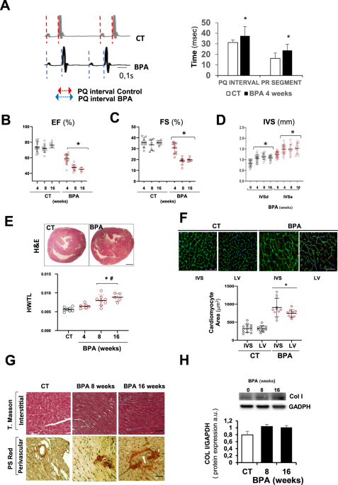 Bisphenol a induces coronary endothelial cell necroptosis by activating rip3/camkii dependent pathway