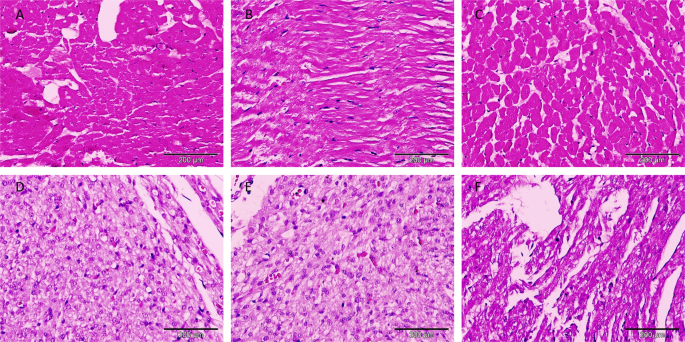 Ginger extract attenuates labetalol induced apoptosis, DNA damage,  histological and ultrastructural changes in the heart of rat fetuses -  ScienceDirect