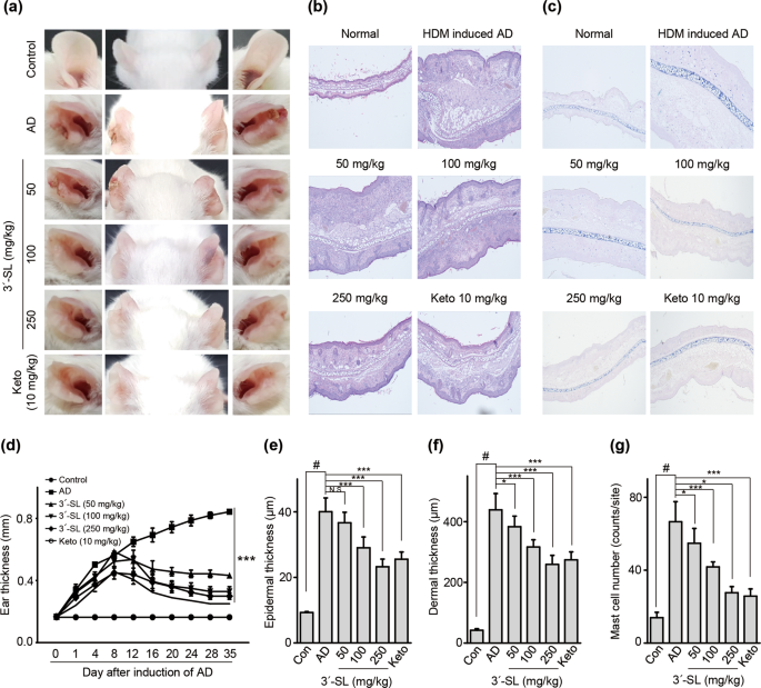 3′-sialyllactose prebiotics prevents skin inflammation via regulatory t cell differentiation in atopic dermatitis mouse models