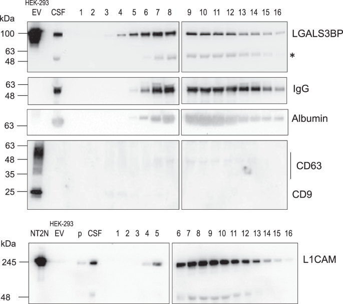 Investigating Lgals3bp 90 K Glycoprotein In The Cerebrospinal Fluid Of Patients With Neurological Diseases Scientific Reports