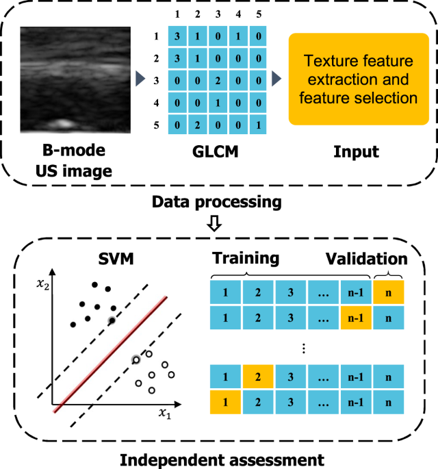 Real-time Burn Classification using Ultrasound Imaging