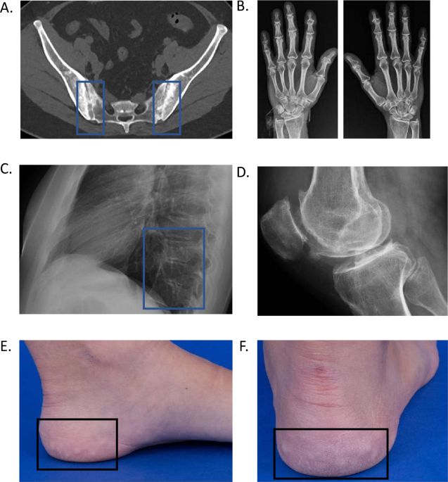 A 52-year-old women with groin pain. (A) The box indicates the probe