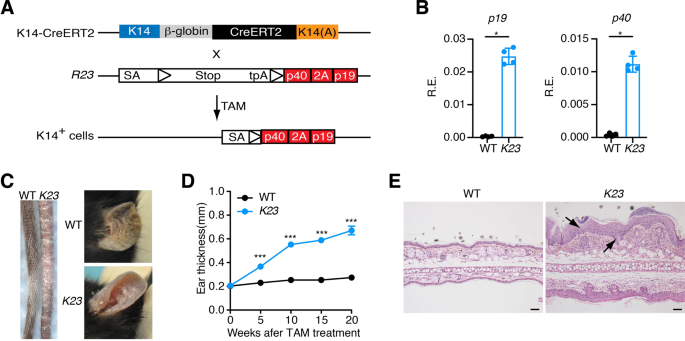 Skin expression of IL-23 drives the development of psoriasis and psoriatic  arthritis in mice | Scientific Reports