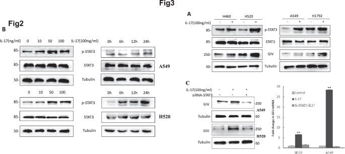 Author correction: interleukin-17 promotes angiogenesis by stimulating vegf production of cancer cells via the stat3/giv signaling pathway in non-small-cell lung cancer