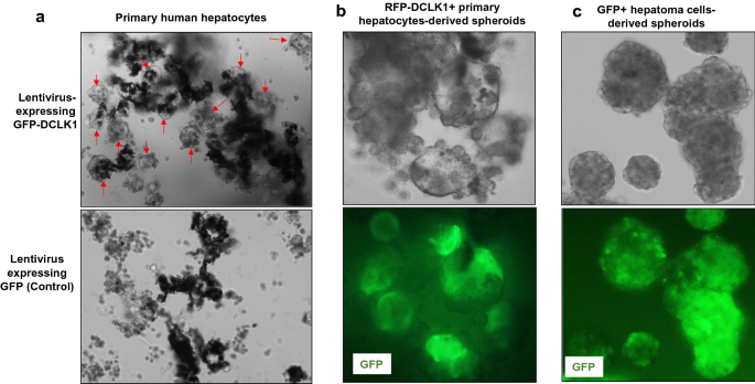Doublecortin Like Kinase 1 Promotes Hepatocyte Clonogenicity And Oncogenic Programming Via Non Canonical B Catenin Dependent Mechanism Scientific Reports