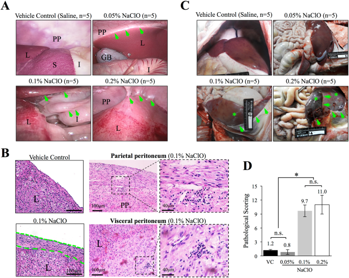 Hypochlorite-induced porcine model of peritoneal fibrosis through the  activation of IL1β-CX3CL1-TGFβ1 signal axis | Scientific Reports