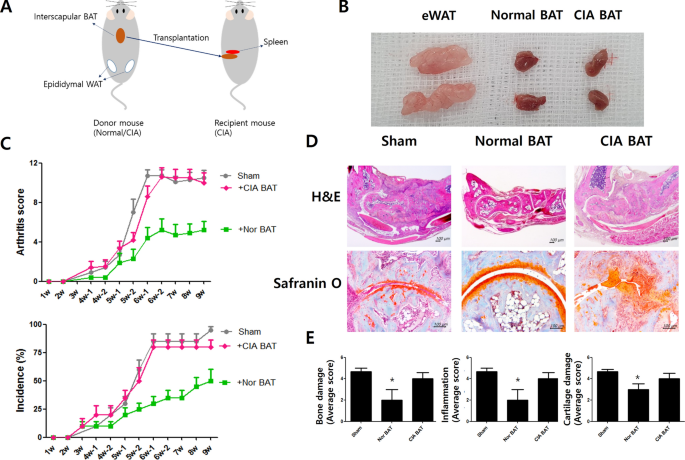 Brown adipose tissue ameliorates autoimmune arthritis via inhibition of  Th17 cells | Scientific Reports