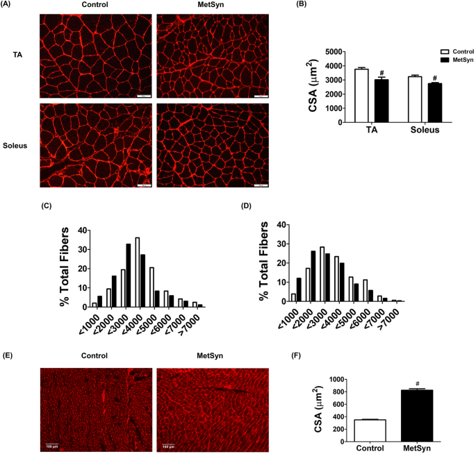 Roles of sarcoplasmic reticulum Ca 2+ ATPase pump in the impairments of  lymphatic contractile activity in a metabolic syndrome rat model |  Scientific Reports