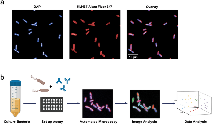 A Novel Therapeutic Antibody Screening Method Using Bacterial High Content Imaging Reveals Functional Antibody Binding Phenotypes Of Escherichia Coli St131 Scientific Reports A Novel Therapeutic Antibody Screening Method Using Bacterial High Content Imaging Reveals Functional Antibody Binding Phenotypes Of Escherichia Coli St131 Scientific Reports