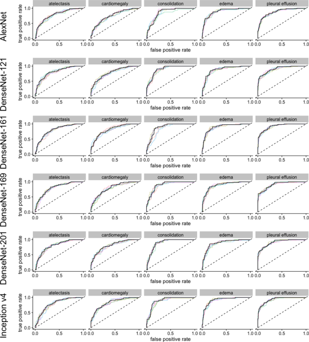 Comparing different deep learning architectures for classification of chest radiographs