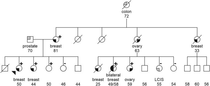 Segregation Analysis Of The Brca2 C 9227g T Variant In Multiple Families Suggests A Pathogenic Role In Breast And Ovarian Cancer Predisposition Scientific Reports