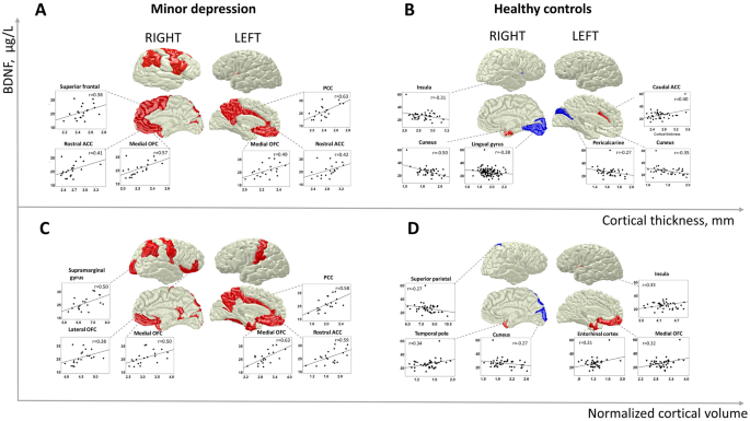 Serum BDNF levels correlate with regional cortical thickness in minor  depression: a pilot study | Scientific Reports