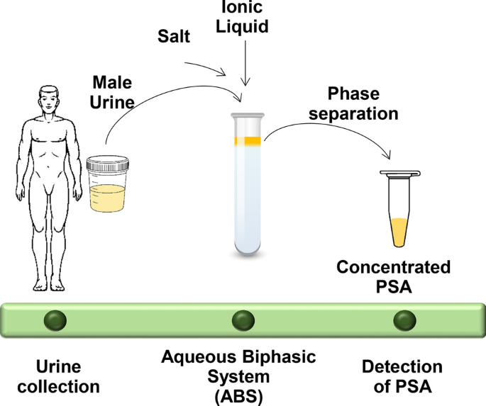 prostate cancer urine test results