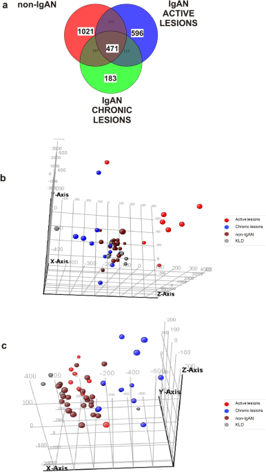 Formalin-fixed paraffin-embedded renal biopsy tissues: an underexploited biospecimen resource for gene expression profiling in iga nephropathy