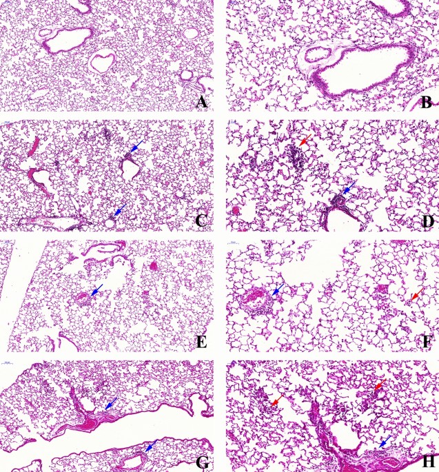 Air pollution impairs recovery and tissue remodeling in a murine model of acute lung injury