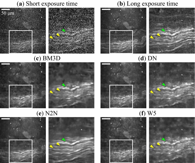 Improvement Of Nerve Imaging Speed With Coherent Anti Stokes Raman Scattering Rigid Endoscope Using Deep Learning Noise Reduction Scientific Reports