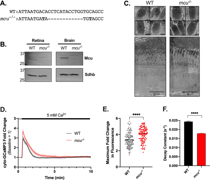 Mitochondrial Calcium Uniporter Mcu Deficiency Reveals An Alternate Path For Ca 2 Uptake In Photoreceptor Mitochondria Scientific Reports