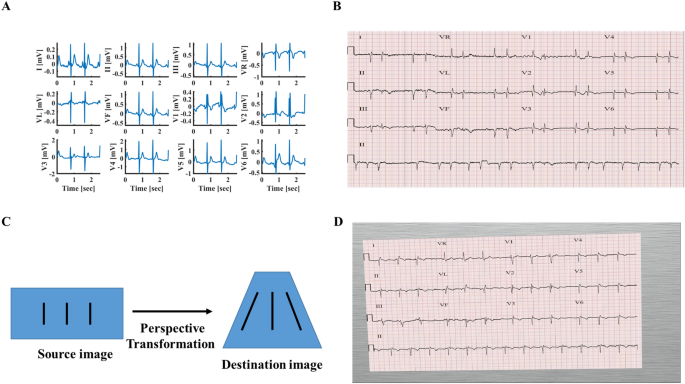 12 Lead ECG/EKG Machine w Interpretation Electrocardiograph Auto-analysed  Result