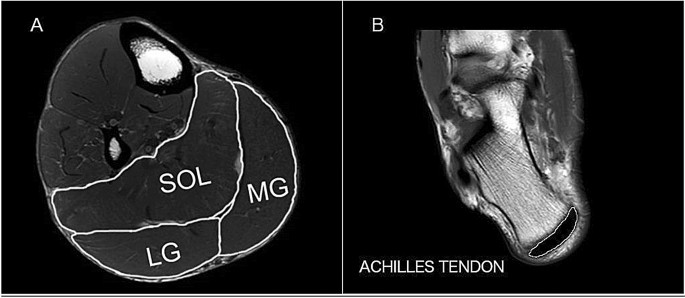 Lower Leg Muscle Tendon Unit Characteristics Are Related To Marathon Running Performance Scientific Reports