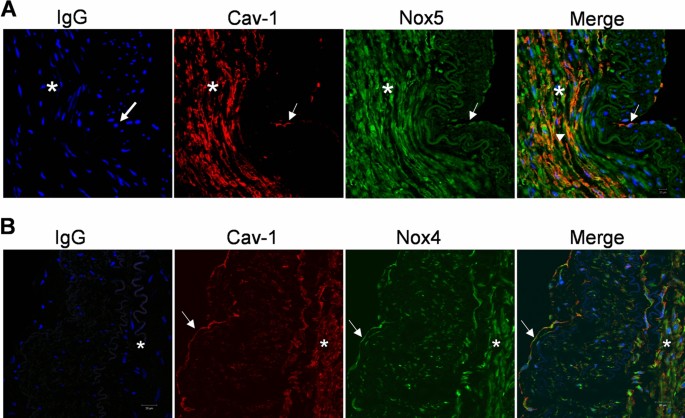 Importance Of Cholesterol Rich Microdomains In The Regulation Of Nox Isoforms And Redox Signaling In Human Vascular Smooth Muscle Cells Scientific Reports Importance Of Cholesterol Rich Microdomains In The Regulation Of Nox Isoforms And Redox Signaling In Human Vascular Smooth Muscle Cells Scientific Reports
