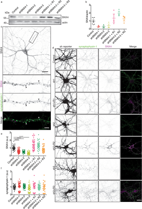 The endosomal protein sorting nexin 4 is a synaptic protein