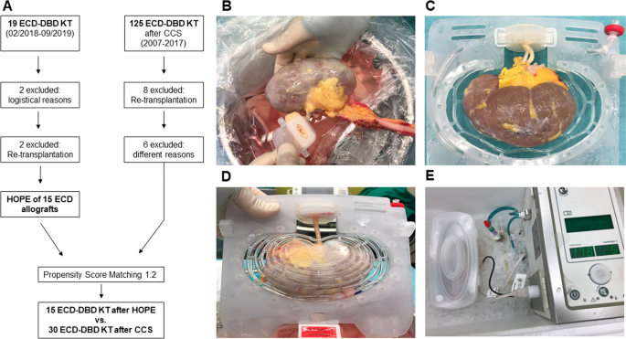 Decrease Of Renal Resistance During Hypothermic Oxygenated Machine Perfusion Is Associated With Early Allograft Function In Extended Criteria Donation Kidney Transplantation Scientific Reports