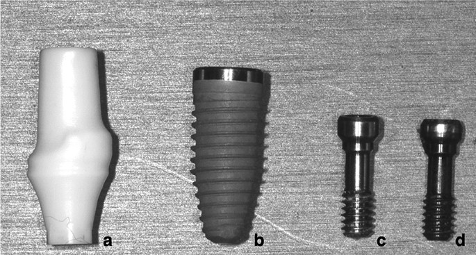 Biomechanical effects of original equipment manufacturer and aftermarket  abutment screws in zirconia abutment on dental implant assembly |  Scientific Reports