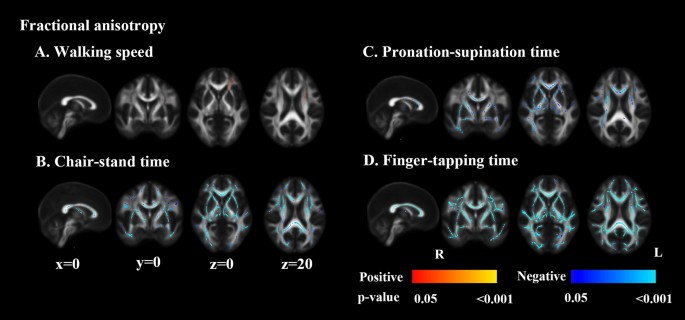 Disrupted white matter integrity and network connectivity are related to  poor motor performance | Scientific Reports