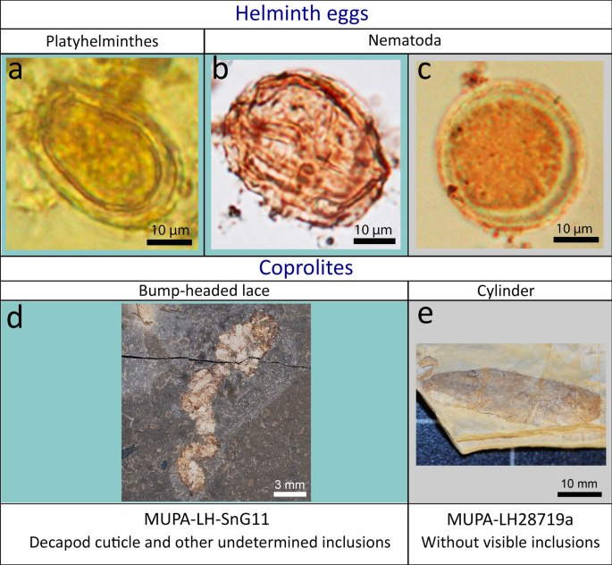 Helminth nematode worms, Simptomele de viermi - Intoxic - Helminth nematode worms