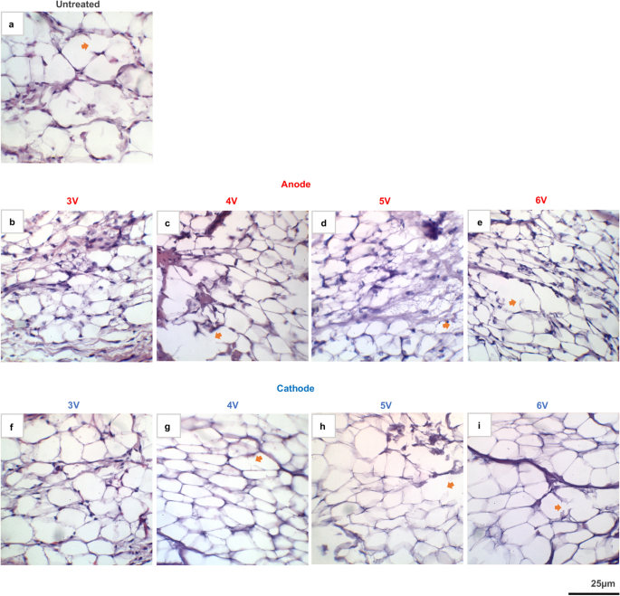 Electrochemical degradation and saponification of porcine adipose tissue |  Scientific Reports