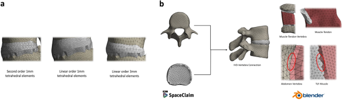 Medical Science Monitor  Biomechanical Behavior of All-on-4 and M-4  Configurations in an Atrophic Maxilla: A 3D Finite Element Method - Article  abstract #929908