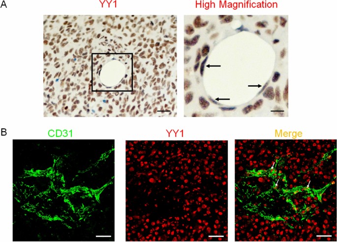 Endothelial specific YY1 deletion restricts tumor angiogenesis and tumor  growth | Scientific Reports