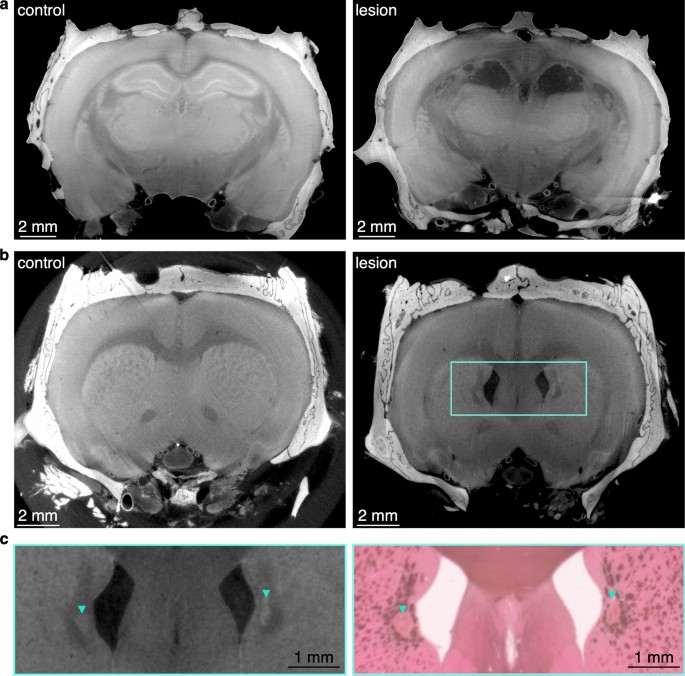 High-resolution micro-CT for 3D infarct characterization and segmentation  in mice stroke models