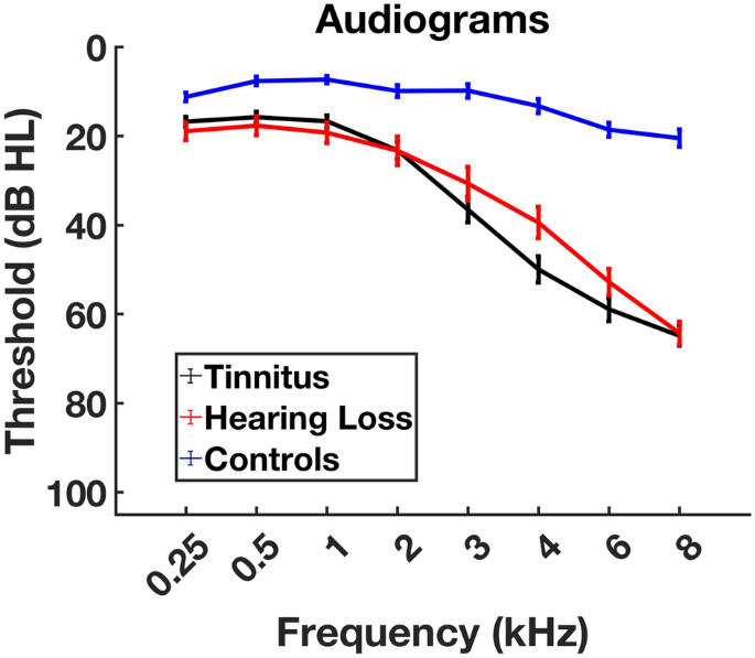 Gray declines with age and hearing loss, but is partially maintained in Scientific Reports