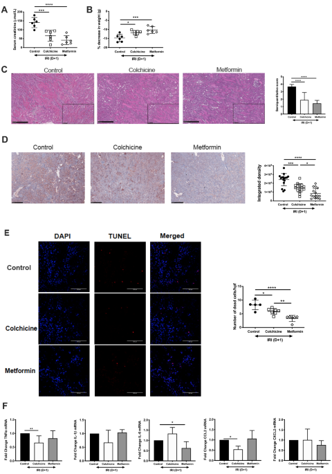 Repurposing Of Metformin And Colchicine Reveals Differential Modulation Of Acute And Chronic Kidney Injury Scientific Reports