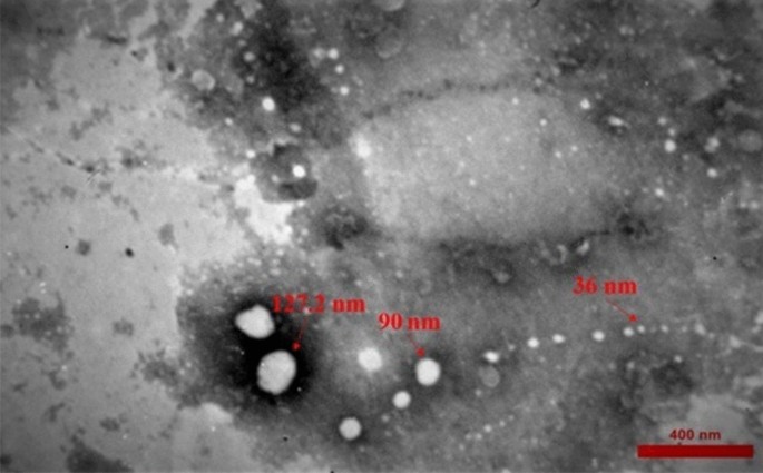 Modulation of serotonin signaling/metabolism by Akkermansia muciniphila and  its extracellular vesicles through the gut-brain axis in mice | Scientific  Reports
