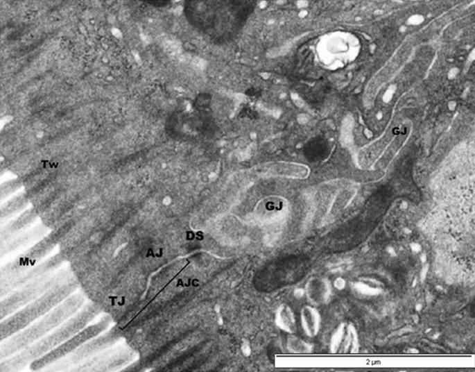 Avian intestinal ultrastructure changes provide insight into the ...