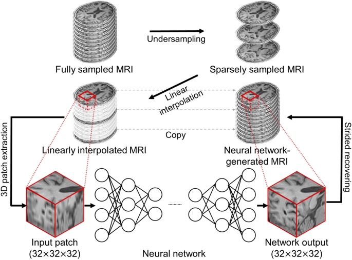 Deep Learning Based 3d Inpainting Of Brain Mr Images Scientific Reports