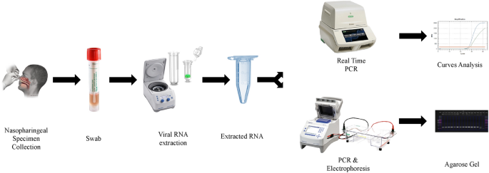 High sensitivity-low cost detection of SARS-CoV-2 by two steps end point RT- PCR with agarose gel electrophoresis visualization | Scientific Reports