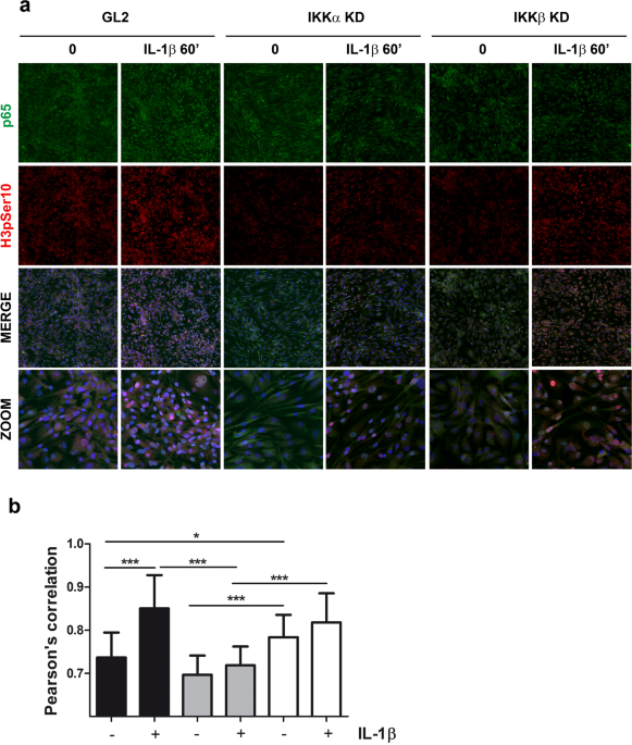 Regulation of MMP-3 expression and secretion by the chemokine eotaxin-1 in  human chondrocytes, Journal of Biomedical Science