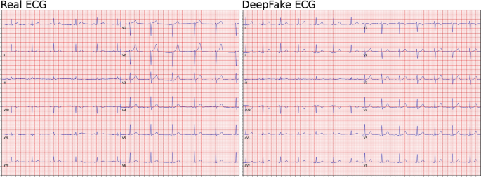 DeepFake electrocardiograms using generative adversarial networks are the  beginning of the end for privacy issues in medicine | Scientific Reports