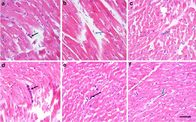 The first observation of osmotically neutral sodium accumulation in the myocardial interstitium | Scientific Reports The first observation of osmotically neutral sodium accumulation in the myocardial interstitium | Scientific Reports