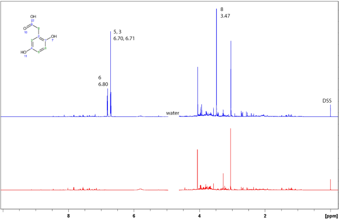 A molecular spectroscopy approach for the investigation of early phase ochronotic pigment development in alkaptonuria