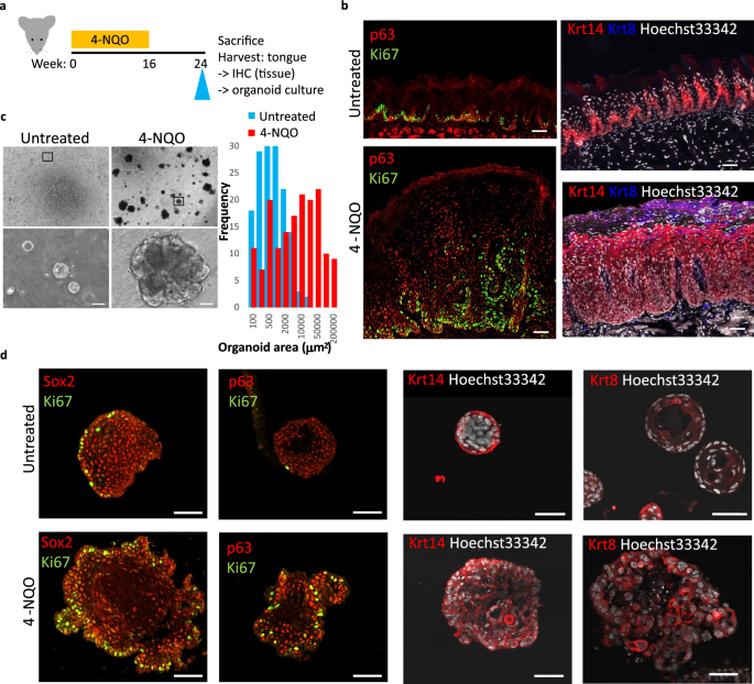Characterization of normal and cancer stem-like cell populations in murine lingual epithelial organoids using single-cell rna sequencing