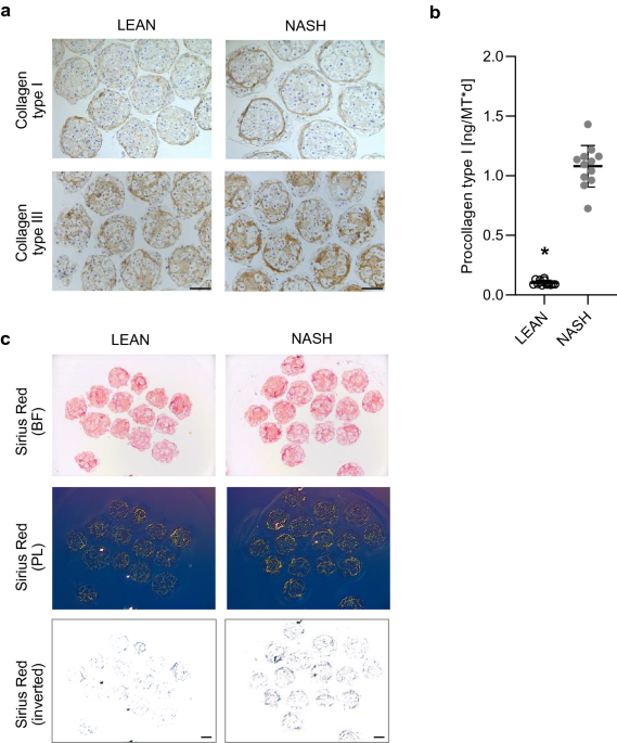 A 3D primary human cell-based in vitro model of non-alcoholic  steatohepatitis for efficacy testing of clinical drug candidates