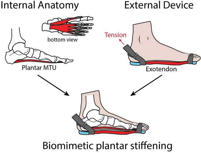 Stiffening the human foot with a biomimetic exotendon | Scientific 