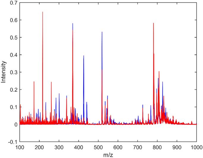 Multivariate Classification Techniques And Mass Spectrometry As A Tool In The Screening Of Patients With Fibromyalgia Scientific Reports