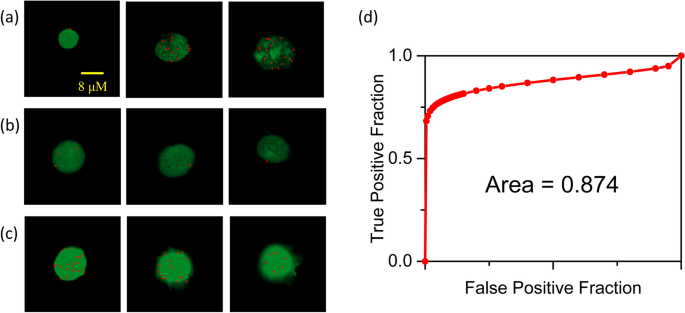 Comparison of cytological adequacy and pain scale score in  ultrasound-guided fine-needle aspiration of solid thyroid nodules for  liquid-based cytology with with 23- and 25-gauge needles: a single-center  prospective study