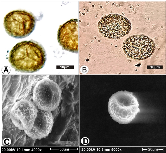 PDF) Spore Morphology and Ornamentation of Fern and Fern-Allies