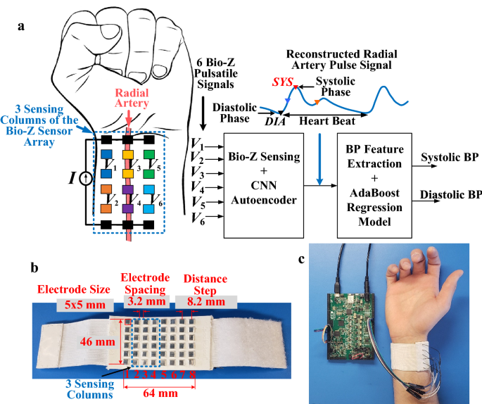Cuffless blood pressure monitoring from a wristband with calibration-free  algorithms for sensing location based on bio-impedance sensor array and  autoencoder | Scientific Reports